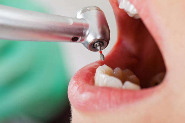 Best Broken Tooth Emergency  in Poolesville, MD